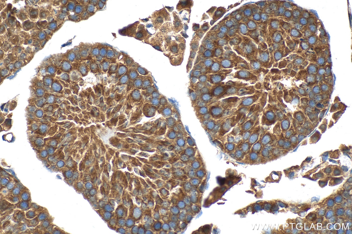 Immunohistochemistry (IHC) staining of mouse testis tissue using RanBP1 Polyclonal antibody (27804-1-AP)