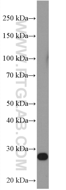 Western Blot (WB) analysis of mouse brain tissue using RanBP1 Polyclonal antibody (27804-1-AP)