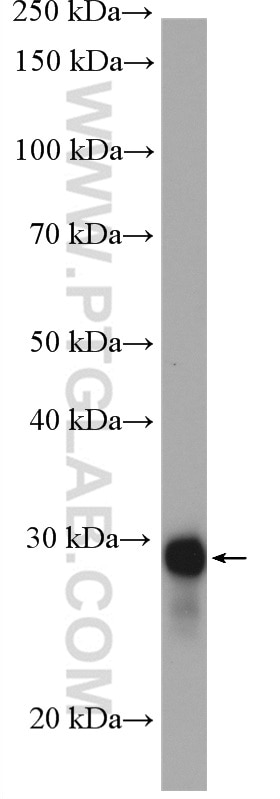 Western Blot (WB) analysis of fetal human brain tissue using RanBP1 Polyclonal antibody (27804-1-AP)