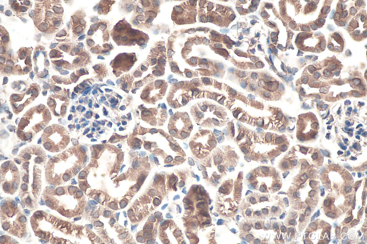 Immunohistochemistry (IHC) staining of mouse kidney tissue using RanBP2 Polyclonal antibody (27606-1-AP)