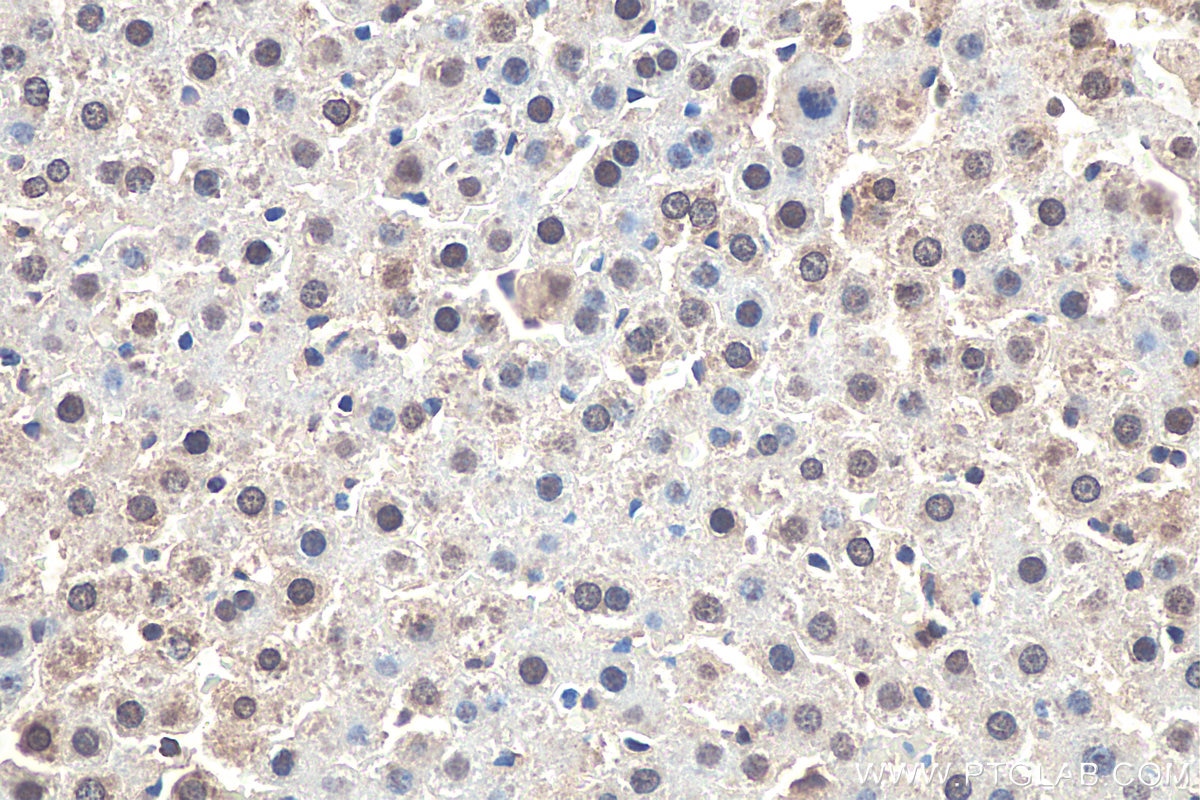 IHC staining of rat liver using 27606-1-AP