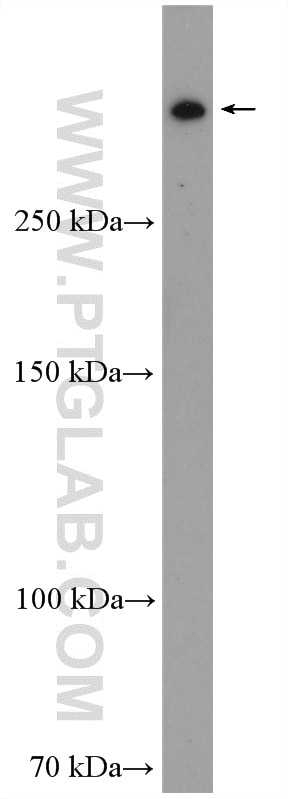 Western Blot (WB) analysis of HeLa cells using RanBP2 Polyclonal antibody (27606-1-AP)