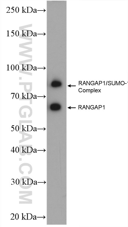 WB analysis of Neuro-2a using 27405-1-AP