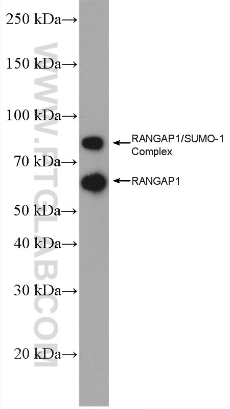 WB analysis of MCF-7 using 27405-1-AP