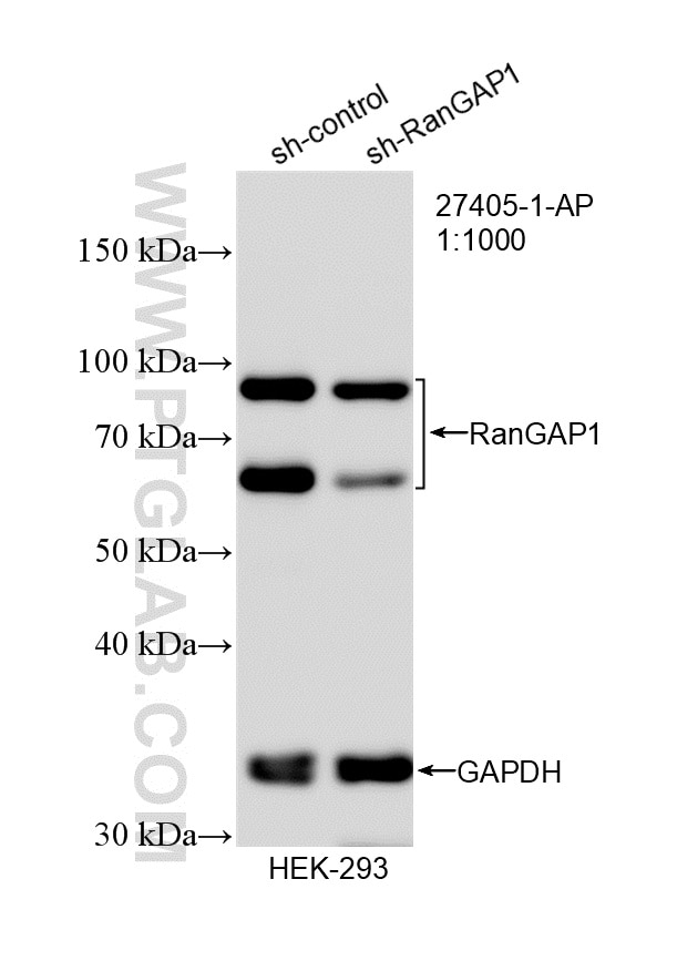 Western Blot (WB) analysis of HEK-293 cells using RanGAP1 Polyclonal antibody (27405-1-AP)