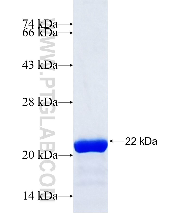 Reck fusion protein Ag37354 SDS-PAGE Reck fusion protein Ag37354 SDS-PAGE