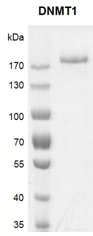 Recombinant DNMT1 protein gel. Recombinant DNMT1 protein was run on an 8% SDS-PAGE gel and stained with Coomassie blue. MW: 188.2 kDa Purity: > 90%