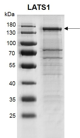 Recombinant LATS1 protein gel 10% SDS-PAGE gel with Coomassie blue staining MW: 128.1 kDa Purity: >73%