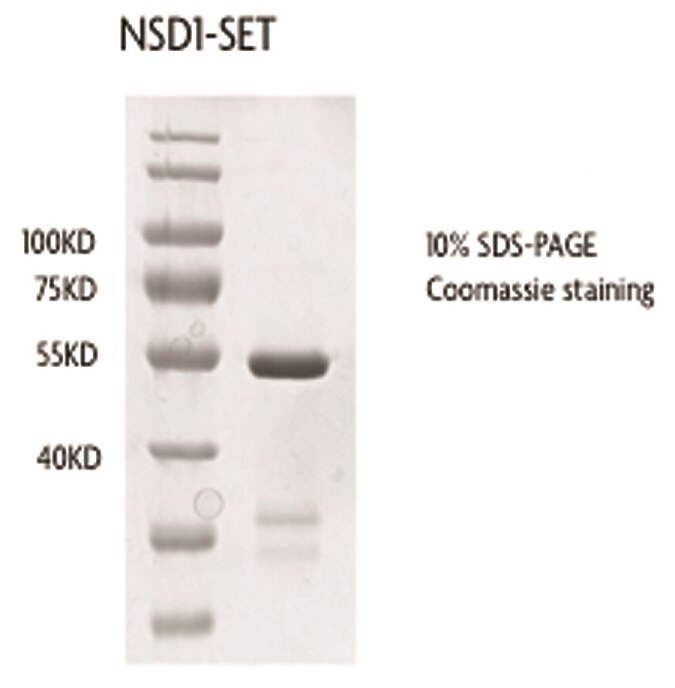 Recombinant NSD1-SET protein | Proteintech