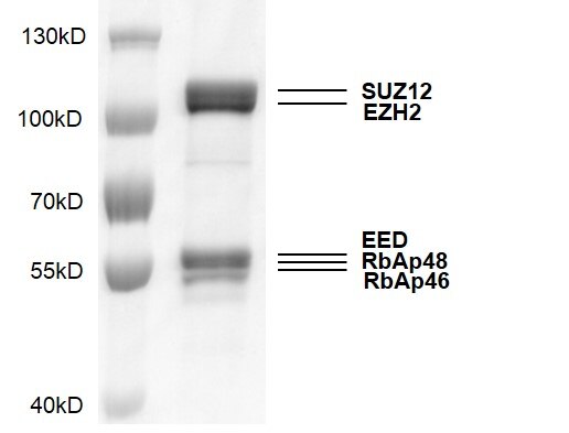 Recombinant PRC2 Complex gel. PRC2 Complex was run on a 10% SDS-PAGE gel and stained with Coomassie blue. MW as follows: EZH2: 87 kDa. SUZ12: 83 kDa. EED: 50.2 kDa. RbAp46: 47.8 kDa. RbAp48: 47.7 kDa. Purity: > 90% Recombinant PRC2 Complex gel. PRC2 Complex was run on a 10% SDS-PAGE gel and stained with Coomassie blue. MW as follows: EZH2: 87 kDa. SUZ12: 83 kDa. EED: 50.2 kDa. RbAp46: 47.8 kDa. RbAp48: 47.7 kDa. Purity: > 90%
