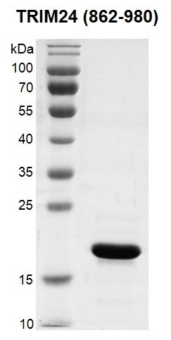 Recombinant TRIM24 (862-980) protein gel.TRIM24 (862-980) protein was run on a 12% SDS-PAGE gel and stained with Coomassie Blue. MW: 18.8 kDa Purity: > 95% Recombinant TRIM24 (862-980) protein gel.TRIM24 (862-980) protein was run on a 12% SDS-PAGE gel and stained with Coomassie Blue. MW: 18.8 kDa Purity: > 95%