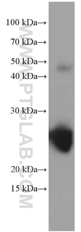 Western Blot (WB) analysis of rat retina tissue using Recoverin Monoclonal antibody (66521-1-Ig)