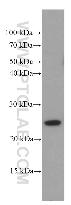 Western Blot (WB) analysis of pig retina tissue using Recoverin Monoclonal antibody (66521-1-Ig)