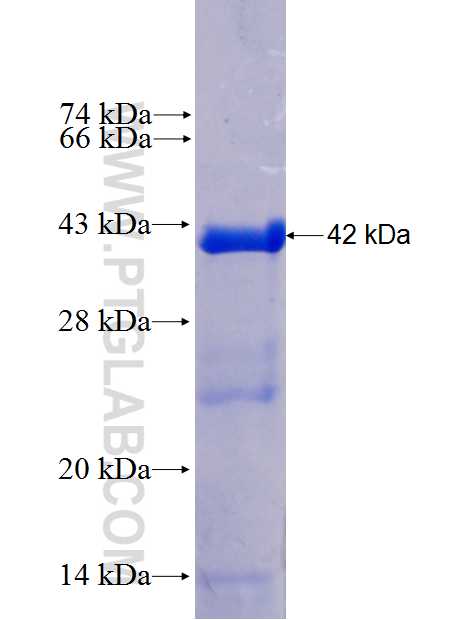 Recoverin fusion protein Ag0119 SDS-PAGE