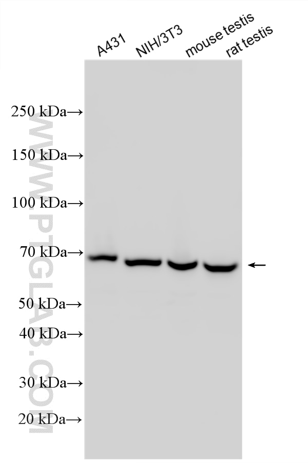 Various lysates were subjected to SDS PAGE followed by western blot with 33259-1-AP (NF-κB p65 antibody) at dilution of 1:20000 incubated at room temperature for 1.5 hours. Western Blot (WB) analysis of various lysates using NF-κB p65 Polyclonal antibody (33259-1-AP)