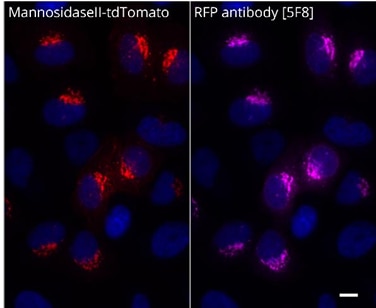 Immunofluorescence of HeLa cells transiently transfected with MannosidaseII-tdTomato