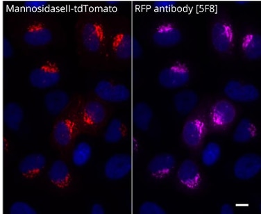 MannosidaseII-tdTomatoを一過性トランスフェクションにより発現させたHeLa細胞の免疫蛍光染色