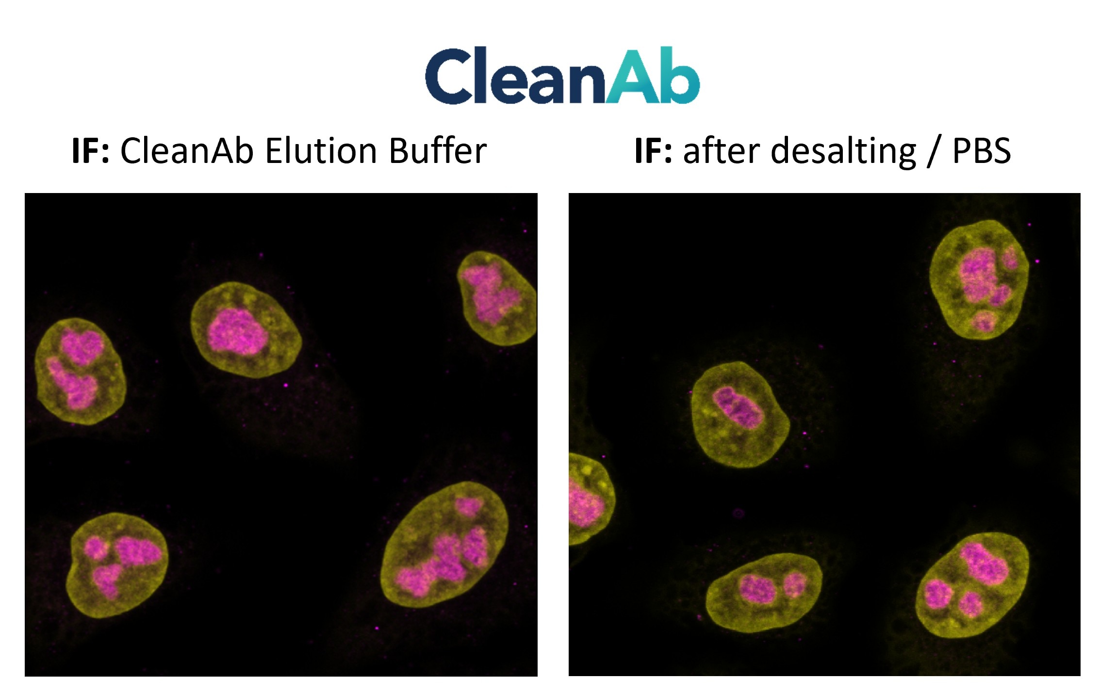 Immunostaining of HeLa cells with mouse anti-B23/NPM1 antibody (60096-1-Ig, 1:100, magenta), chemically conjugated to a 15-nt DNA oligonucleotide and purified using CleanAb beads. Detection was performed by hybridization with an imaging DNA strand labeled with ATTO643. Nuclei were counterstained with DAPI (yellow). Direct comparison of CleanAb product and desalted product demonstrates functionality of both products. Immunostaining of HeLa cells with mouse anti-B23/NPM1 antibody (60096-1-Ig, 1:100, magenta), chemically conjugated to a 15-nt DNA oligonucleotide and purified using CleanAb beads. Detection was performed by hybridization with an imaging DNA strand labeled with ATTO643. Nuclei were counterstained with DAPI (yellow). Direct comparison of CleanAb product and desalted product demonstrates functionality of both products.