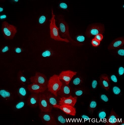 HeLa cells transiently transfected with human CD16 were immunostained with anti-CD16 recombinant VHH, CoraLite ® Plus 555 (CL555-CD16, 1:500, red). Nuclei were stained with DAPI (cyan). Epifluorescence images were acquired with a 20x objective and post-processed.
Note: Immunostaining with CL555-CD16 can be performed live or after formaldehyde fixation.