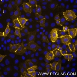 Live HeLa cells transfected with human LAG3 were immunostained with CoraLite® Plus 555 conjugated-LAG3 VHH (CL555-lt, 1:500, yellow). Cells were fixed and nuclei were stained with DAPI (blue). Epifluorescence images were acquired with a 20x objective and post-processed. 
Note: Immunostaining with CL555-lt can also be performed after formaldehyde fixation of the cells.