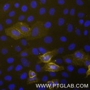 Live HeLa cells transfected with human TIGIT were immunostained with CoraLite® Plus 555 conjugated-TIGIT VHH (CL555-tgt,1:1000, yellow). Cells were fixed and nuclei were stained with DAPI (blue). Epifluorescence images were acquired with 20x objective and post-processed. 
Note: Immunostaining with CL555-tgt can also be performed after formaldehyde fixation of the cells.