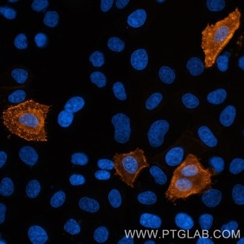 Live HeLa cells transfected with human TIGIT were immunostained with CoraLite® Plus 555 conjugated-TIGIT VHH (CL555-tgt,1:1000, orange). Cells were fixed and nuclei were stained with DAPI (blue). Epifluorescence images were acquired and post-processed with Leica Thunder Imager, 40x objective. 
Note: Immunostaining with CL555-tgt can also be performed after formaldehyde fixation of the cells.