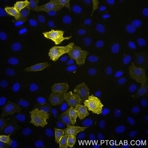 Live HeLa cells transfected with human TIM-3 were immunostained with CoraLite® Plus 555 conjugated-TIM3 VHH (CL555-tmt, 1:1000, yellow). Cells were fixed and nuclei were stained with DAPI (blue). Epifluorescence images were acquired with 20x objective and post-processed. 
Note: Immunostaining with CL555-tmt can also be performed after formaldehyde fixation of the cells.