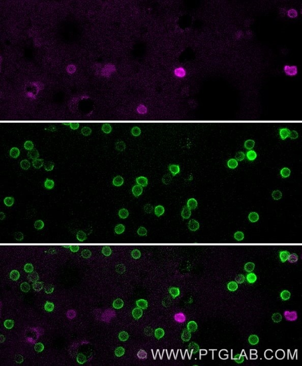 Live human PBMCs were gravity-sedimented and immunostained with anti-CD16 recombinant VHH, CoraLite ® Plus 647 (CL647-CD16, magenta) and anti-CD3 IgG-CL488 (CL488-65151, green). Images were acquired with a 20x objective and post-processed. Dead cells (autofluorescent in all channels including UV and far-red) we subtracted from all channels with ImageJ.
Note: Immunostaining with CL647-CD16 can be performed live or after formaldehyde fixation.