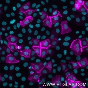 Live HeLa cells transfected with human LAG3 were immunostained with CoraLite® Plus 647 conjugated-LAG3 VHH (CL647-lt, 1:500, magenta). Cells were fixed and nuclei were stained with DAPI (cyan). Epifluorescence images were acquired with a 20x objective and post-processed. 
Note: Immunostaining with CL647-lt can also be performed after formaldehyde fixation of the cells.