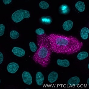 Live HeLa cells transfected with human TIGIT were immunostained with CoraLite® Plus 647 conjugated-TIGIT VHH (CL647-tgt,1:1000, magenta). Cells were fixed and nuclei were stained with DAPI (cyan). Epifluorescence images were acquired and post-processed with Leica Thunder Imager, 40x objective. 
Note: Immunostaining with CL647-tgt can also be performed after formaldehyde fixation of the cells.
