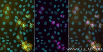 Live HeLa cells transfected with human TIGIT were immunostained with CoraLite® Plus 555 conjugated-TIGIT VHH (CL555-tgt,1:1000, yellow). After formaldehyde fixation, triton permeabilization and blocking with BSA, the intracellular pool of TIGIT was immunostained with CoraLite® Plus 647 conjugated-TIGIT VHH (CL647-tgt,1:1000, magenta). Cell nuclei were stained with DAPI (cyan). Epifluorescence images were acquired with a 20x objective and post-processed.