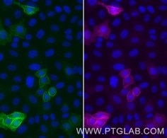 Live HeLa cells transfected with human TIGIT were probed with human recombinant anti-TIGIT IgG. After formaldehyde fixation, the cells were immunostained with CoraLite® Plus 647 conjugated-TIGIT VHH (CL647-tgt,1:1000, magenta) and with anti-human IgG Nano-Secondary (shuGCL488-2, green). Cell nuclei were stained with DAPI (blue). 
Epifluorescence images were acquired with 20x objective and post-processed.