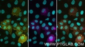 Live HeLa cells transfected with human TIM-3 were immunostained with CoraLite® Plus 555 conjugated-TIM3 VHH (CL555-tmt,1:1000, yellow). After formaldehyde fixation, triton permeabilization and blocking with BSA, intracellular pool of TIM-3 was immunostained with CoraLite® Plus 647 conjugated-TIM3 VHH (CL647-tmt, 1:1000, magenta). Cell nuclei were stained with DAPI (cyan). Epifluorescence images were acquired with a 20x objective and post-processed.