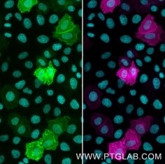Live HeLa cells transfected with human TIM-3 were probed with cobolimab biosimilar (anti-TIM3, huIgG4). After formaldehyde fixation, the cells were immunostained with CoraLite® Plus 647 conjugated-TIM3 VHH (CL647-tmt, 1:1000, magenta) and with anti-human IgG Nano-Secondary (shuGCL488-2, green). Cell nuclei were stained with DAPI (cyan). Epifluorescence images were acquired with 20x objective and post-processed.