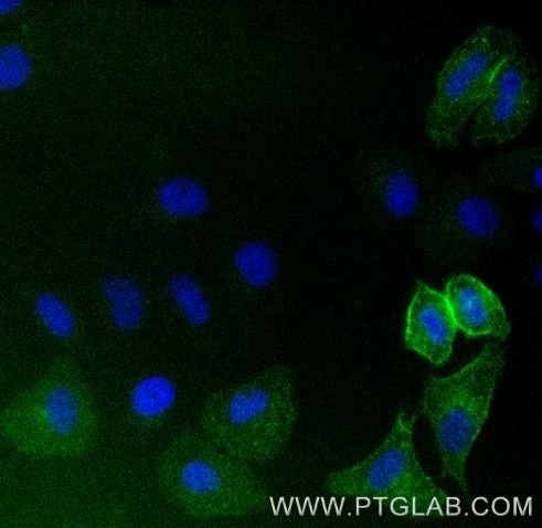 HeLa cells transiently transfected with human CD16 were immunostained with anti-CD16 VHH-FITC (code, 1:500, green). Nuclei were stained with DAPI (blue). Epifluorescence images were acquired with a 20x objective and post-processed.
Note: Immunostaining with anti-CD16-VHH-Dye can be performed live or after formaldehyde fixation. 