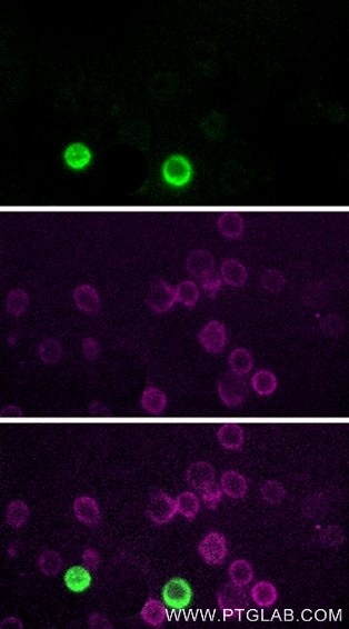 Live human PBMCs were gravity-sedimented and immunostained with anti-CD16 recombinant VHH, FITC Plus (FITC-CD16, green) and anti-CD3 IgG-CL555 (CL555-65151, magenta). Images were acquired with a 20x objective and post-processed. Dead cells (autofluorescent in all channels including UV and far-red) we subtracted from all channels with ImageJ.
Note: Immunostaining with FITC-CD16 can be performed live or after formaldehyde fixation. 
