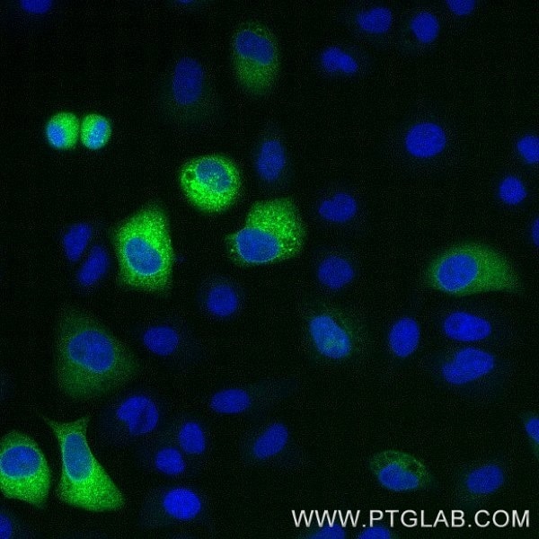 HeLa cells transiently transfected with human IFNg were immunostained with anti IFNy recombinant VHH, FITC Plus (FITC-IFNg, green). Nuclei are in blue. Cells were treated with Brefeldin A and Monensin for 6 hours. 