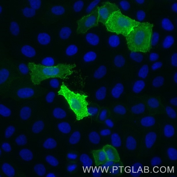 Live HeLa cells transfected with human TIGIT were immunostained with FITC Plus conjugated-TIGIT VHH (FITC-tgt,1:1000, green). Cells were fixed and nuclei were stained with DAPI (blue). Epifluorescence images were acquired with 20x objective and post-processed. 
Note: Immunostaining with FITC-tgt can also be performed after formaldehyde fixation of the cells.