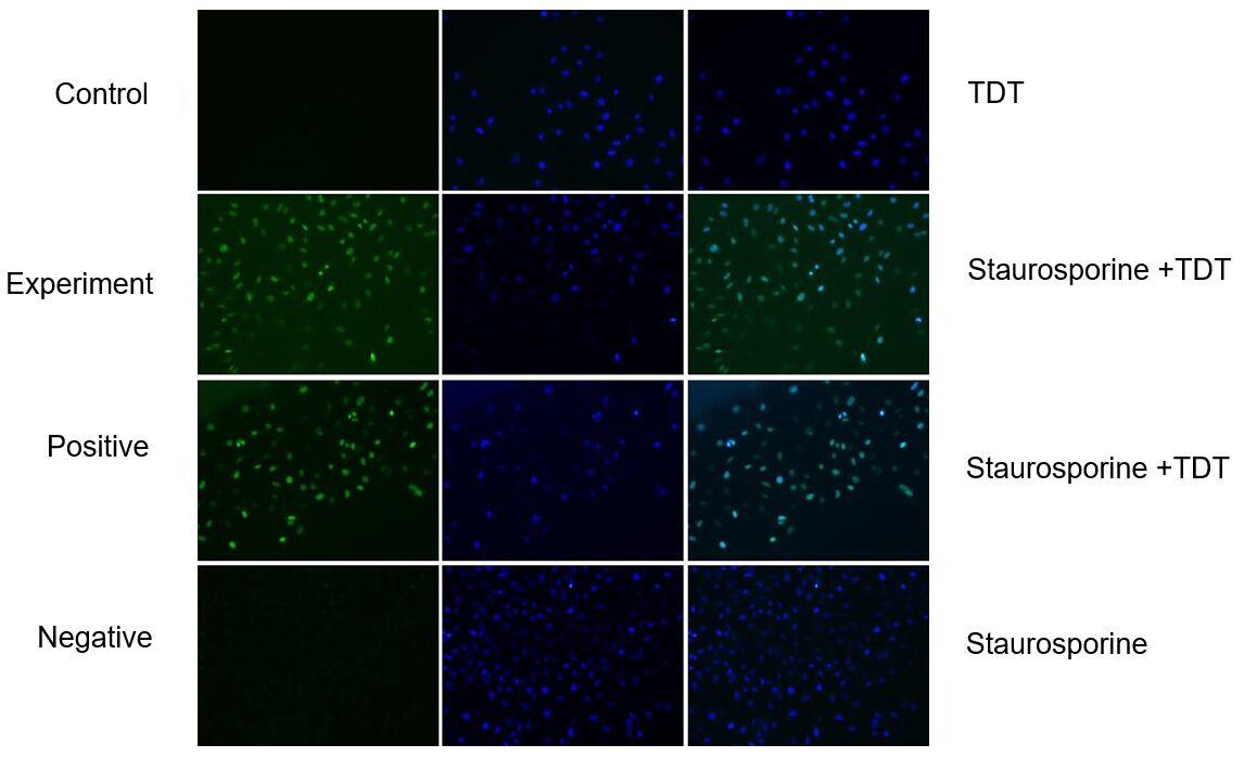 Staurosporine treated HeLa cells for 4.5 h.
