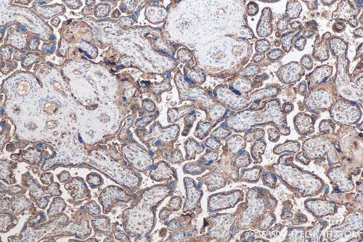 IHC analysis of human placenta tissue using Proteintech’s SLC2A3 rabbit polyclonal antibody (20403-1-AP) and IHC Detect Kit for Rabbit/Mouse Primary Antibody (PK10006).