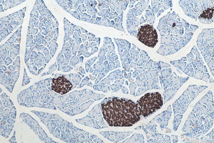 IHC analysis of mouse pancreas tissue using Proteintech’s Insulin mouse monoclonal antibody (66198-1-Ig) and IHC Detect Kit for Mouse Primary Antibody (PK10010).