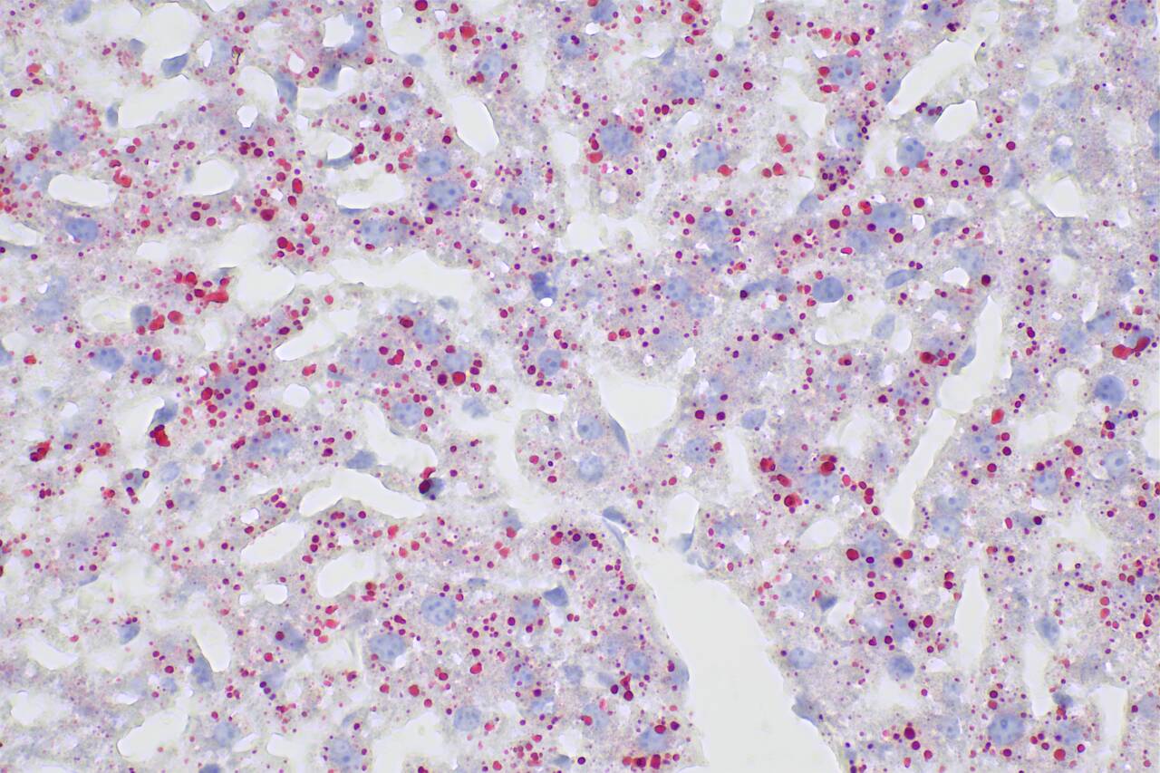 Staining result of frozen mouse liver section by using PK10040. Staining result of frozen mouse liver section by using PK10040.