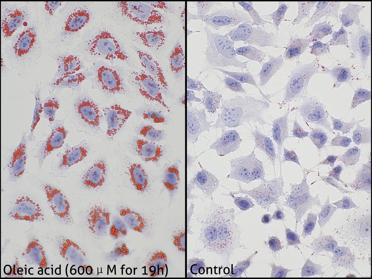 Staining results of oleic acid-treated HeLa cells using PK10040 (left), with untreated HeLa staining serving as a negative control (right). Staining results of oleic acid-treated HeLa cells using PK10040 (left), with untreated HeLa staining serving as a negative control (right).