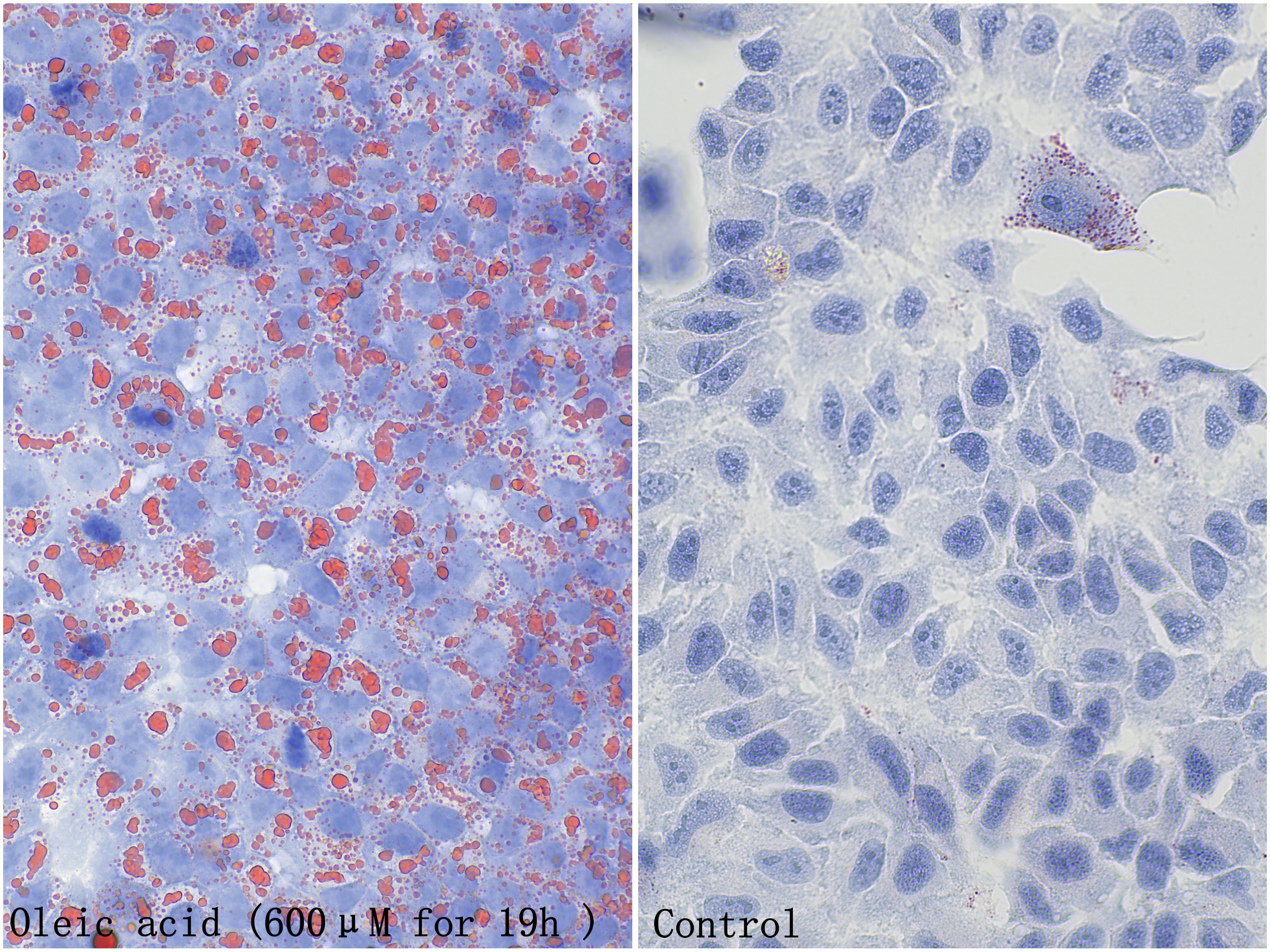 Staining results of oleic acid-treated HepG2 cells using this product (left), with untreated HepG2 staining serving as a negative control (right). Staining results of oleic acid-treated HepG2 cells using this product (left), with untreated HepG2 staining serving as a negative control (right).
