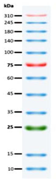 <strong>Migration patterns of Broad Range Prestained Protein Ladder in different electrophoretic conditions</strong><br>The apparent molecular weight of each protein (kDa) has been determined by calibration of each protein against an unstained protein ladder in specific electrophoresis conditions. 