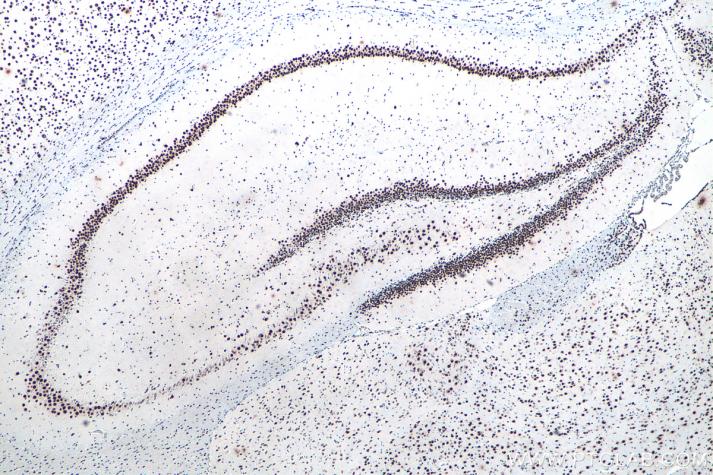 IHC analysis of rat brain tissue with Proteintech’s TDP-43 rabbit recombinant antibody (80001-1-RR). Heat-induced epitope retrieval was performed using Sodium Citrate Antigen Retrieval Buffer  (PR30001).