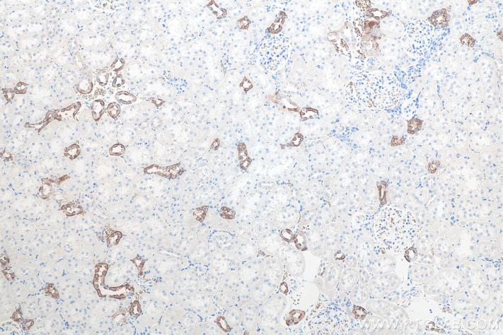 IHC analysis of rat kidney tissue with Proteintech’s AQP2 rabbit polyclonal antibody (29386-1-Ap). Heat-induced epitope retrieval was performed using Sodium Citrate Antigen Retrieval Buffer  (PR30001).