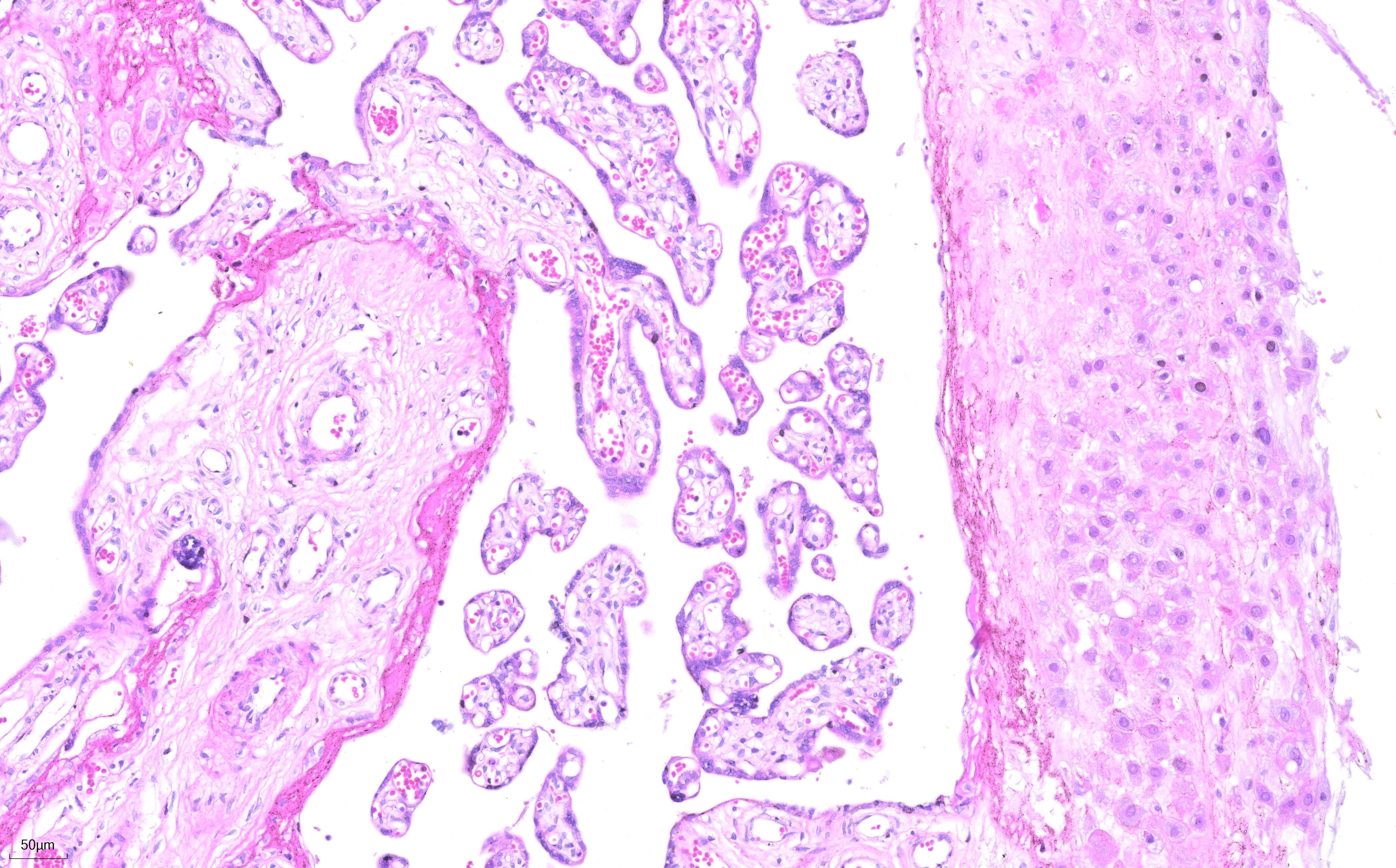 FFPE human placenta tissue was stained with PR30004 (Mayer's Hematoxylin Solution) and PR30019 (Eosin Staining Solution).