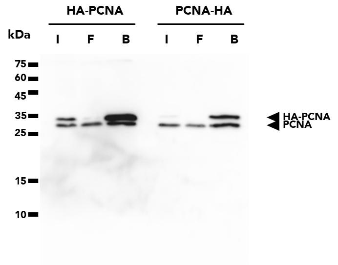 The HA-Trap Magnetic Particles M-270 was used to immunoprecipitate HA-PCNA and PCNA-HA proteins from transfected HEK293T cells. WB analysis was done on samples from the Input (I), Flow-Through (F), and Bound (B) fractions of the IP using PCNA Monclonal Antibody (60097-1-Ig) and Multi-rAb HRP-Goat Anti-Mouse Recombinant Secondary Antibody (RGAM001). The HA-Trap is succesful in pulling down HA-tagged PCNA regardless of whether the tag is fused to the N- or C-terminal. Note: PCNA forms trimers, resulting in co-elution of endogenous PCNA with HA-tagged PCNA.