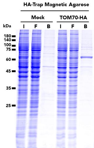 The HA-Trap Magnetic Agarose Kit was used to immunoprecipitate TOM70-HA fusion protein from either untransfected (mock) HEK293T cells or HEK293T cell transfected with full-length TOM70-HA construct. SDS-PAGE analysis was done on samples from the Input (I), Flow-through (F), Bound (B) fractions.